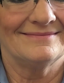 After image for Melissa Turner