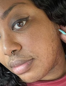 Before image for Faith Walker