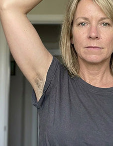 Before image for Jennifer Hall