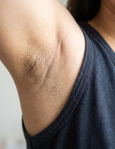 Before image for Melissa Carter