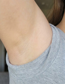 After image for Melissa Carter