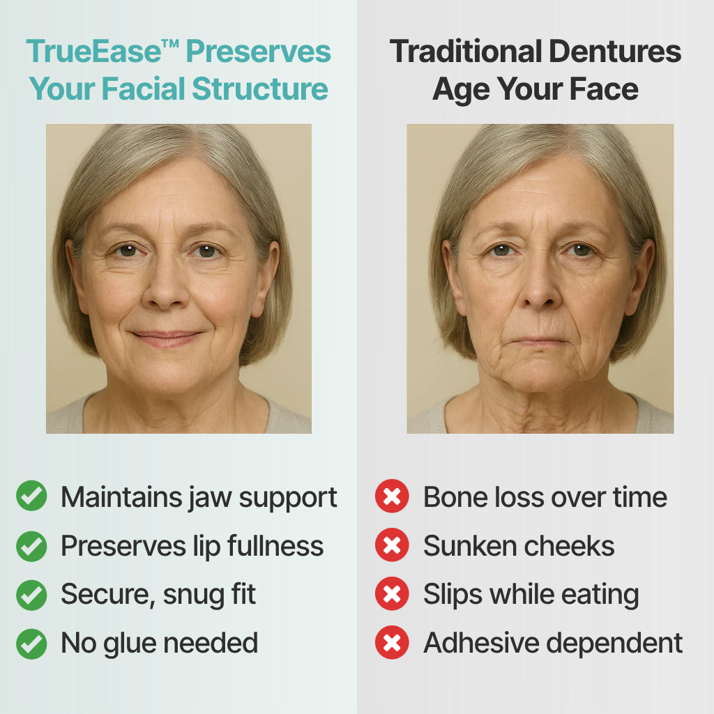SmileFit™ Custom-Fit Full Functional Dentures