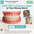 SmileFit™ Custom-Fit Full Functional Dentures